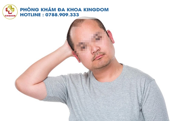 Phương pháp HAT khắc phục rất tốt cho các trường hợp tóc thưa, hói đầu