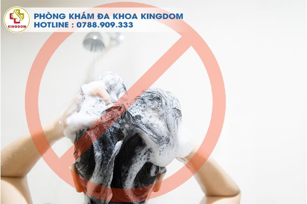 Nên tránh gội đầu mạnh và tránh sử dụng dầu gội có chất tẩy rửa mạnh để không làm hỏng nang tóc